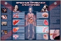 Электрифицированный стенд "Вредные привычки: алкоголизм" - «globural.ru» - Набережные Челны