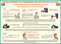 Таблица Порядок действий при опасном кровотечении 1000*1400 винил - «globural.ru» - Набережные Челны